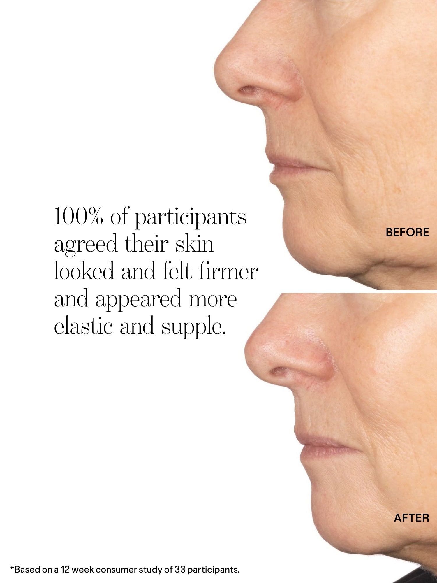 Very Amazing Retinal